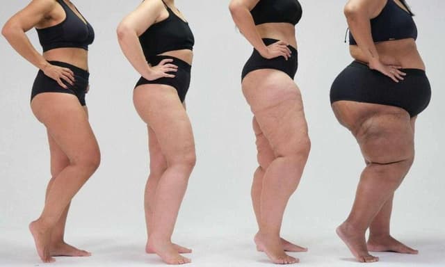 Congresso Lipedema Science 2026 reúne especialistas nacionais e internacionais para debater avanços no diagnóstico e tratamento da doença