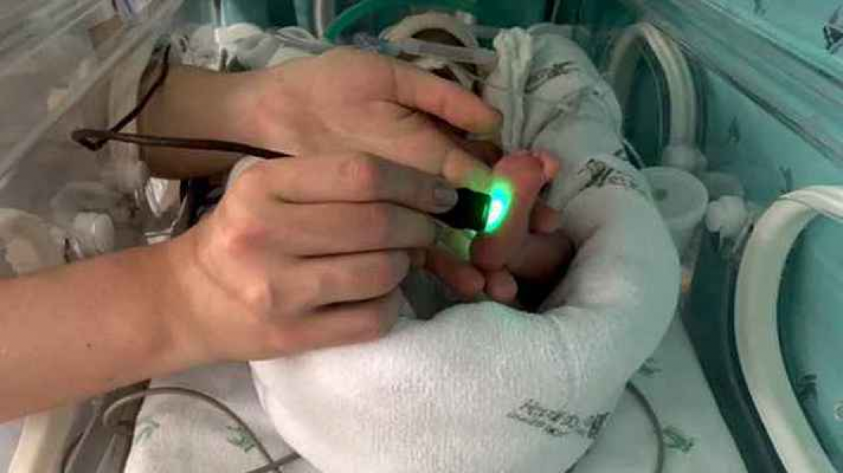 Tecnologia que usa luz de LED para calcular idade gestacional de bebês